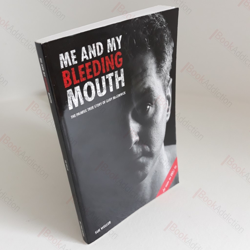 Me and My Bleeding Mouth : The Painful True Story of Gary McCormick