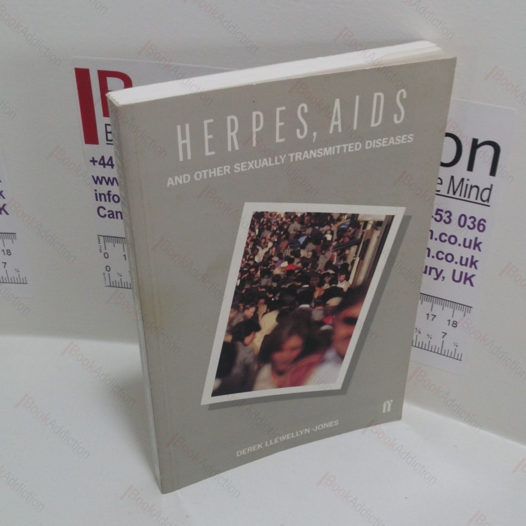 Herpes, AIDS and Other Sexually Transmitted Diseases