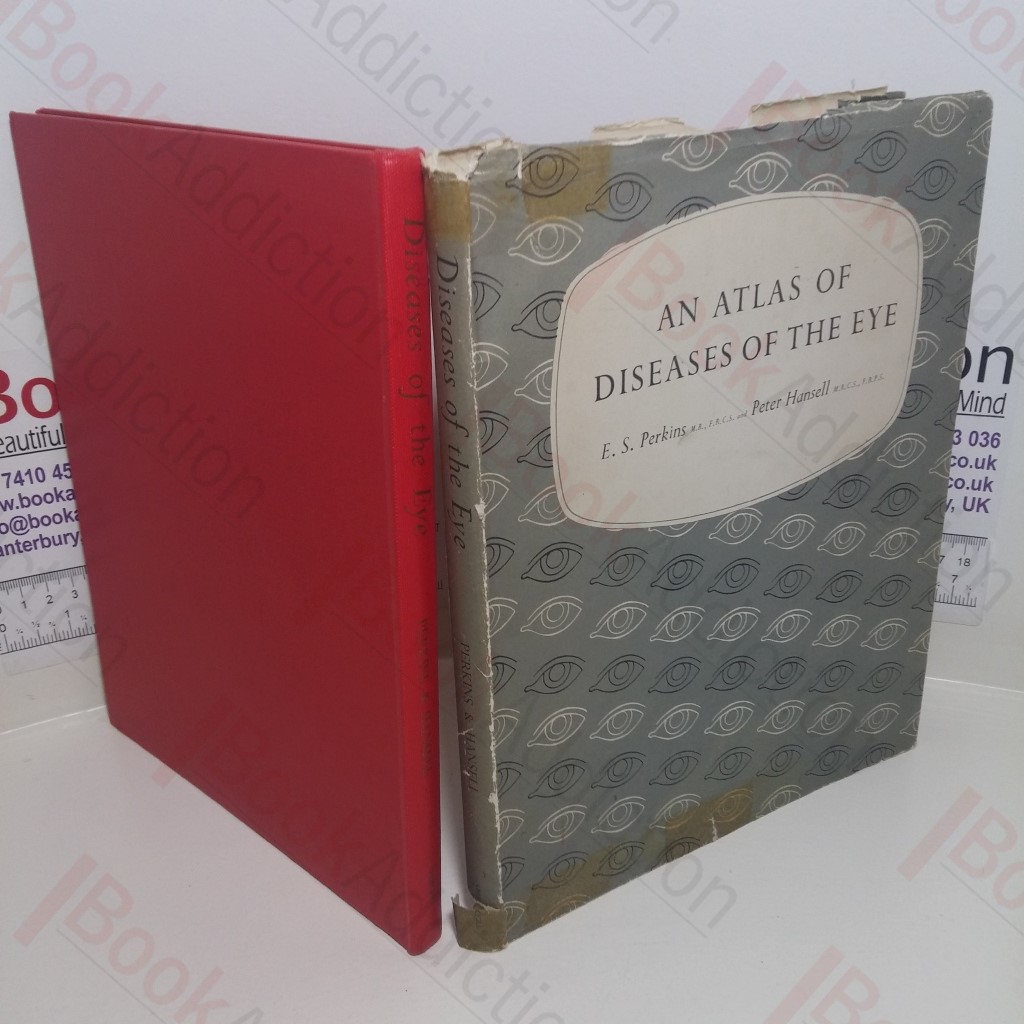 An Atlas of Diseases of the Eye